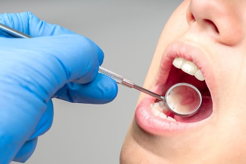 ¿Qué es la periodoncia y por qué es crucial para la salud de tus encías?